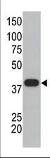 1 - SUMO1 Antibody (C-term) AP1222a