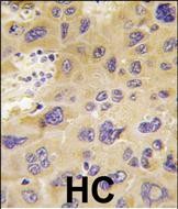 14 - PFKFB1 Antibody (N-term) AP8147a