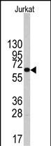 1 - PFKFB1 Antibody (Center) AP8147c