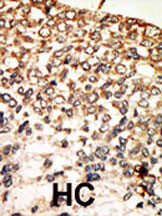 14 - PKA C-alpha/PKA C-beta Antibody (N-term) AP7013a