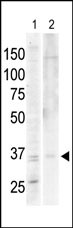 1 - PKA C-alpha/PKA C-beta Antibody (N-term) AP7013a