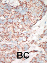 14 - YSK Antibody (C-term) AP7956a