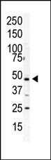 1 - PIP5K2 Alpha (PIP5K2A) Antibody (C-term) AP8041b