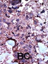 14 - PKLR Antibody (N-term) AP7043a