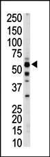 1 - PKLR Antibody (C-term) AP7043b
