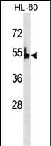 1 - PKLR Antibody (C-term) AP7043b