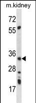 1 - AMPK beta2 (PRKAB2) Antibody (N-term) AP7046a