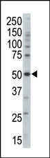 1 - PRKAG3 Antibody (Center) AP7050C