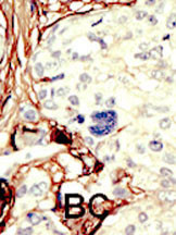 14 - STK11 (LKB1) Antibody (C-term) AP7239B