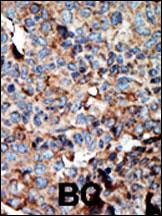 14 - NME2 Antibody (N-term) AP8081a