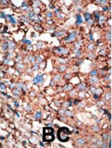 14 - HSP40 Antibody AP1334a