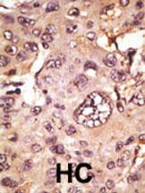 14 - TAU Antibody (C-term) AP2040B