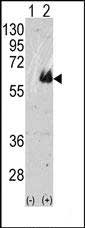 1 - TAU Antibody (C-term) AP2040B