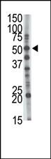 1 - GCNT1 Antibody (Center) AP2404a