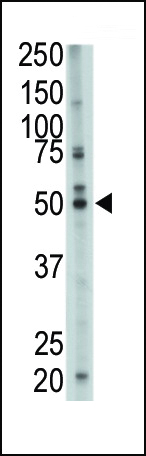 1 - FDFT1 Antibody (N-term) AP2417A