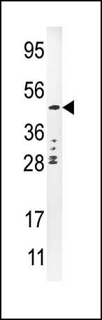 1 - Urokinase (PLAU) Antibody (C-term) AP8161B