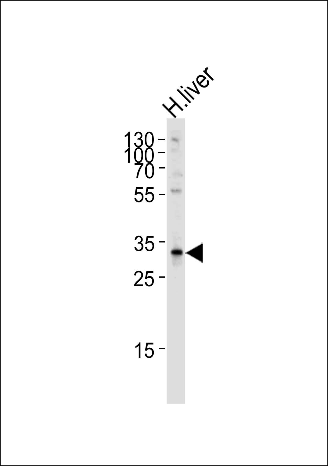 1 - SULT2A Antibody (C-term) AP2603b