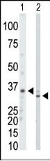1 - PRPS1/PRPS2/PRPS3 Antibody (N-term) AP7061A