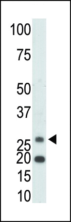 1 - Ketohexokinase (KHK) Antibody (C-term) AP7069b
