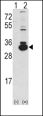 1 - Ketohexokinase (KHK) Antibody (C-term) AP7069b