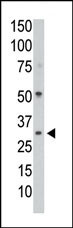 1 - PP1C gamma (PPP1CC) Antibody (N-term) AP8432a
