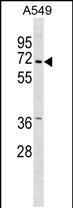 1 - PINK1 (PARK6) Antibody (Center) AP6406B