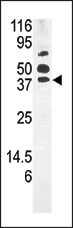 1 - PANK1 Antibody (Center) AP7159b
