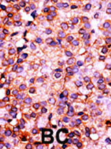 14 - PANK3 Antibody (N-term) AP7161a