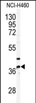 1 - PANK3 Antibody (N-term) AP7161a