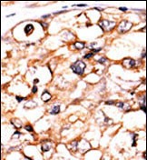 14 - PGK2 Antibody (N-term) AP7170a