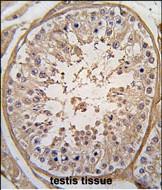 14 - PGK2 Antibody (N-term) AP7170a