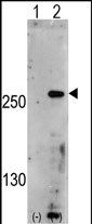 1 - PIP5K3 Antibody (Center) AP7172a