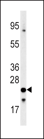 1 - FXN Antibody (C-term) AP6409B