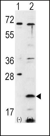 1 - FXN Antibody (C-term) AP6409B
