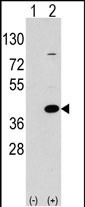 1 - EPM2A Antibody (C-term) AP1453b