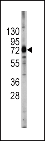 1 - ABCG2 (BCRP) Antibody (Center) AP1490c