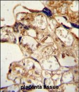 14 - ABCG2 (BCRP) Antibody (Center) AP1490c