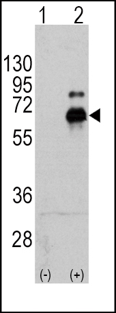 1 - S6K (RPS6KB1) Antibody (S424) AP3289G