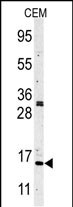 1 - Histone H3 Antibody(N-term) AP1051a