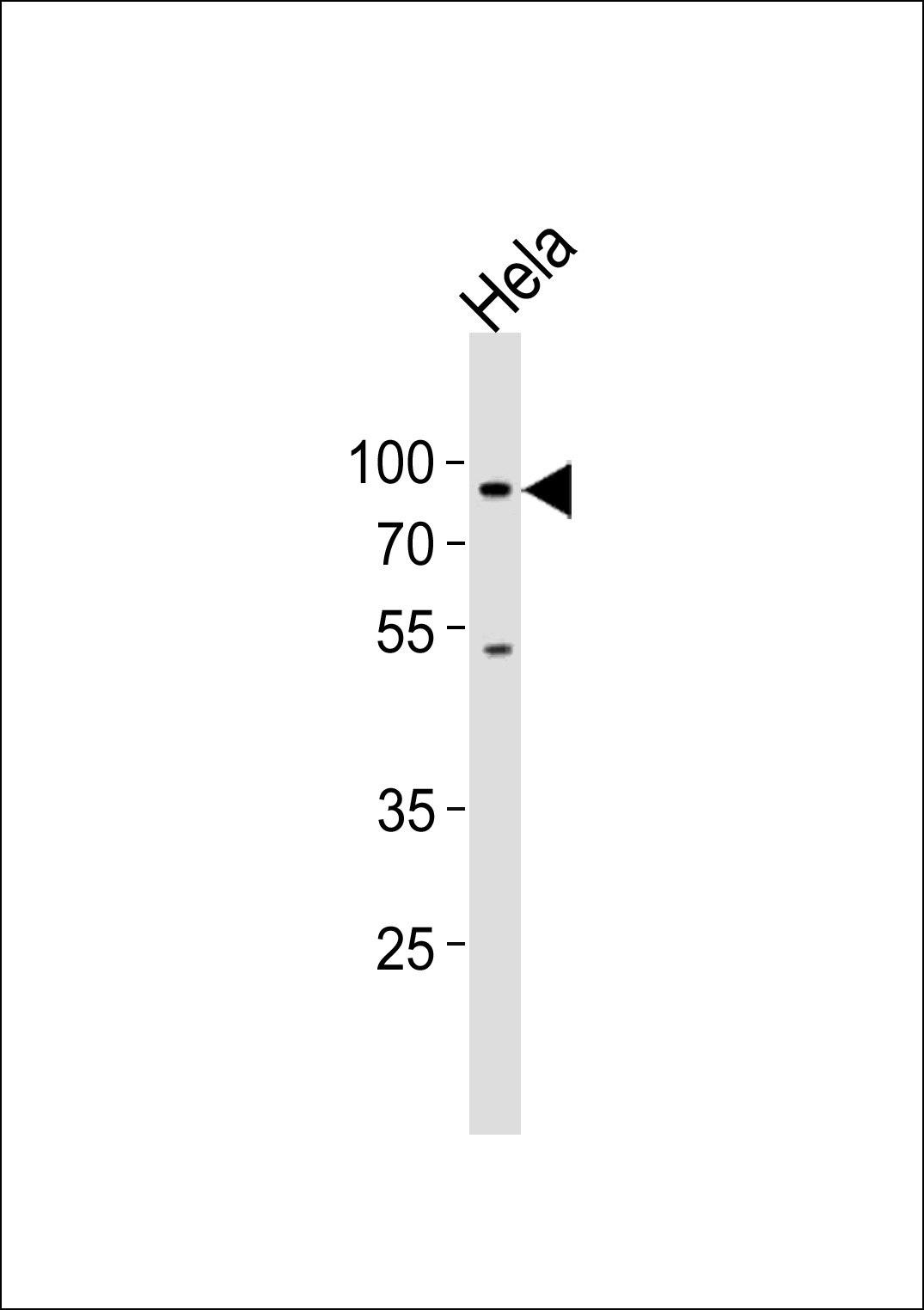 1 - HBO1/MYST2 Antibody (C-term) AP1113b