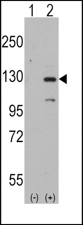 1 - DAAM1 Antibody (N-term) AP2720a
