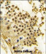 14 - HBO1/MYST2 Antibody (Center) AP1113c