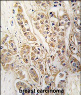 14 - CLIC4 Antibody AP7564a