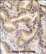 14 - RAF1 Antibody (S233) AP7816e