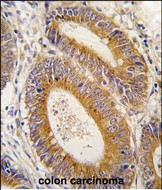 14 - YARS2 Antibody (N-term) AP7838a