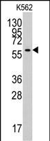 1 - YARS2 Antibody (N-term) AP7838a