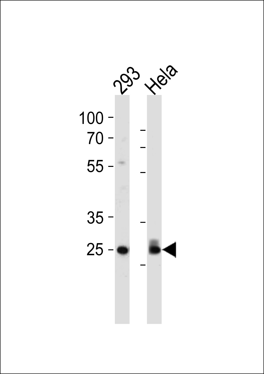 Cdk2 Antibody T14 Affinity Purified Rabbit Polyclonal Antibody Pab Ihc P Wb E Buy Now