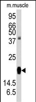 1 - RGS19 Antibody (S151) AP1820f