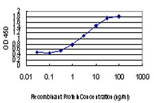 10 - ABCC8 Antibody (monoclonal) (M01) AT1009a