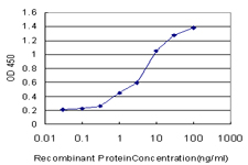 10 - ACADVL Antibody (monoclonal) (M01) AT1019a